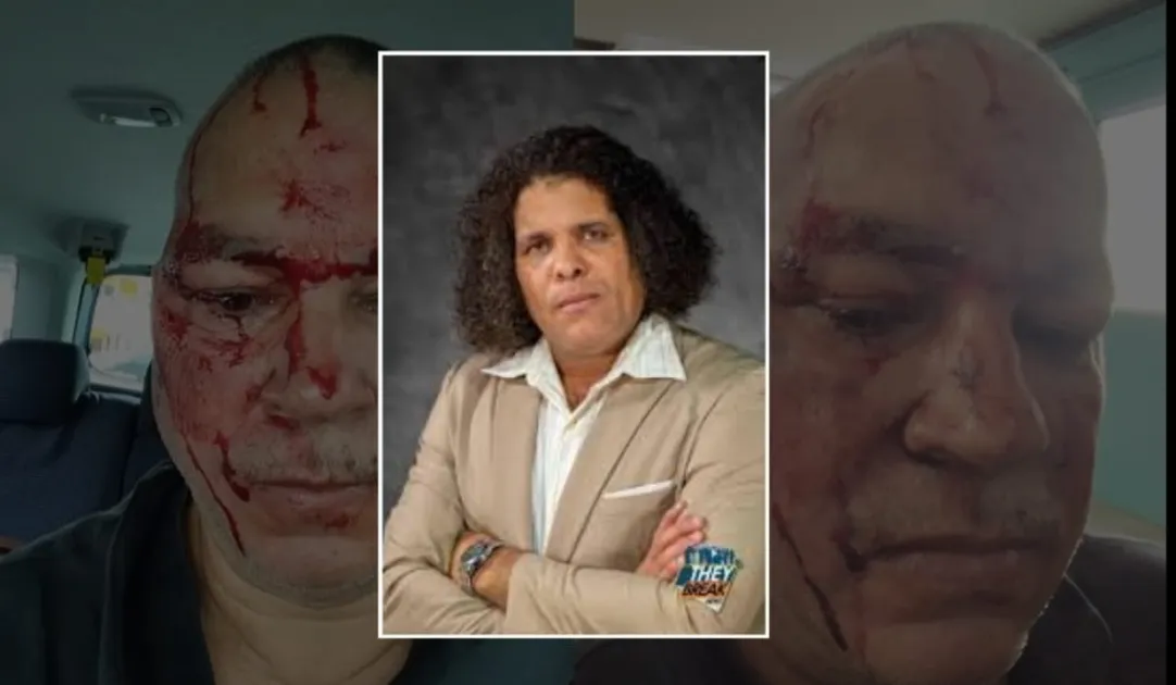 Bryan Max was invited to Mikhael Rodrigues' (Guyanese Critic) studio where he was brutally beaten live on camera. Bryan Max was invited to Mikhael Rodrigues' (Guyanese Critic) studio where he was brutally beaten live on camera.