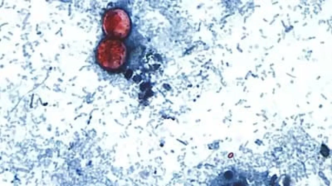 US health officials are investigating whether contaminated fresh produce is behind the outbreak, although no specific food item or supplier has been identified as the source of the infections.